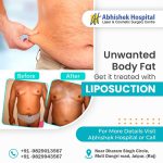 Liposuction Surgery