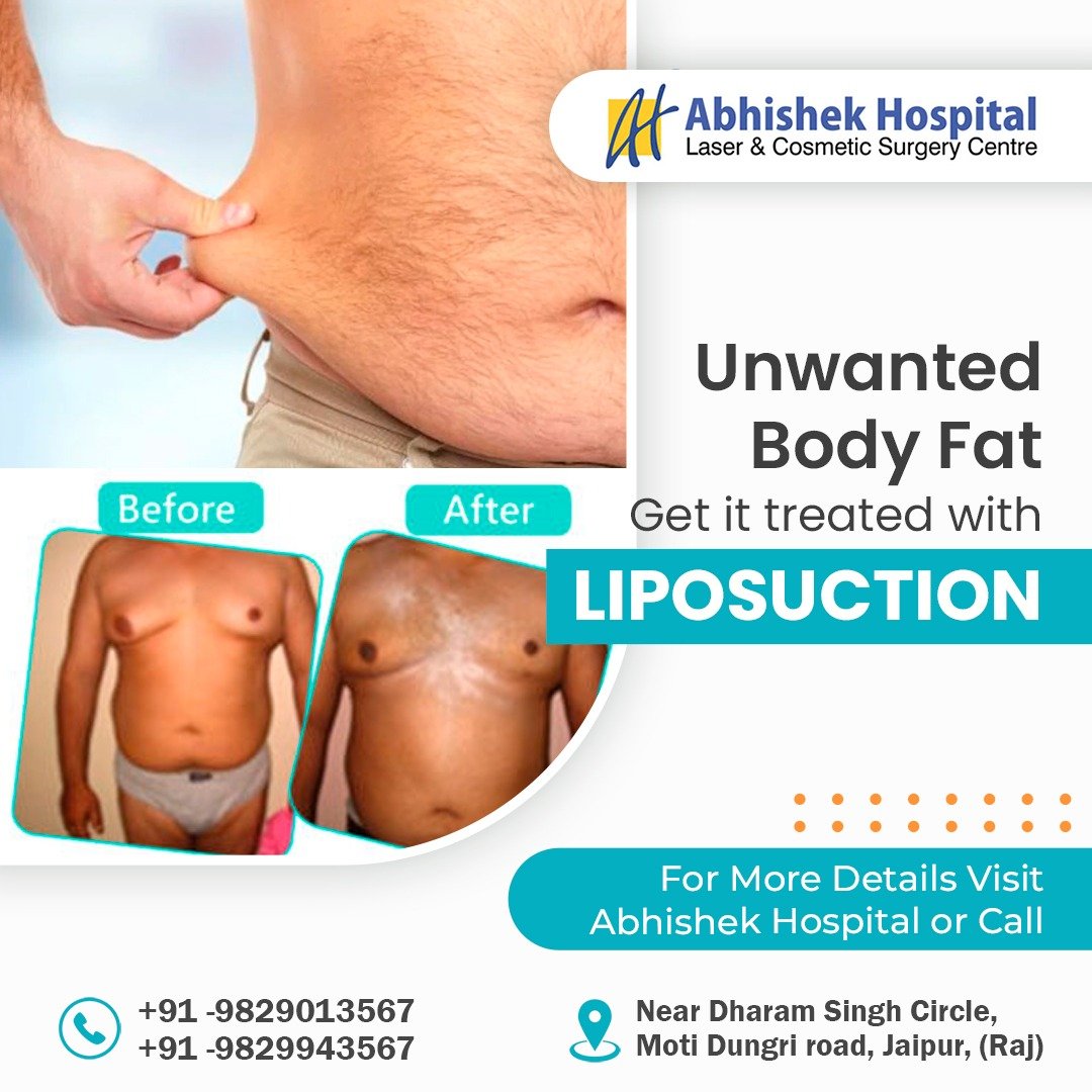 Liposuction Surgery
