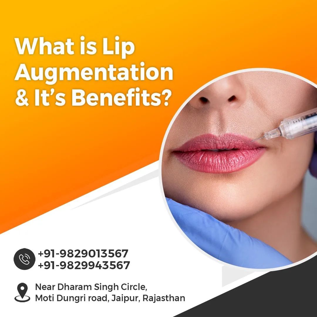 Benefits of Lip Augmentation