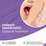 Halitosis causes