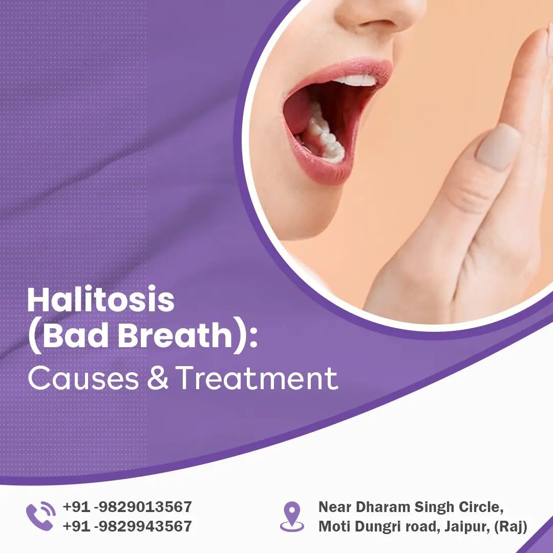 Halitosis causes