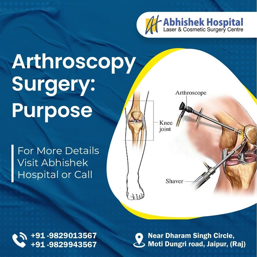 Arthroscopy Surgery