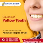 Yellow Teeth Causes