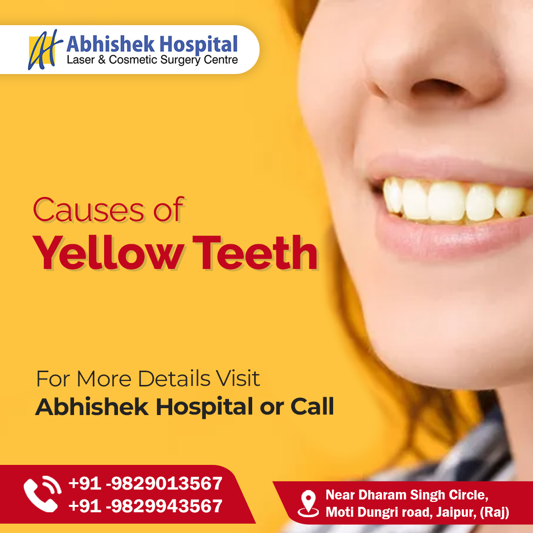 Causes of Yellow Teeth
