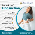 liposuction benefits