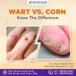 Wart vs. Corn