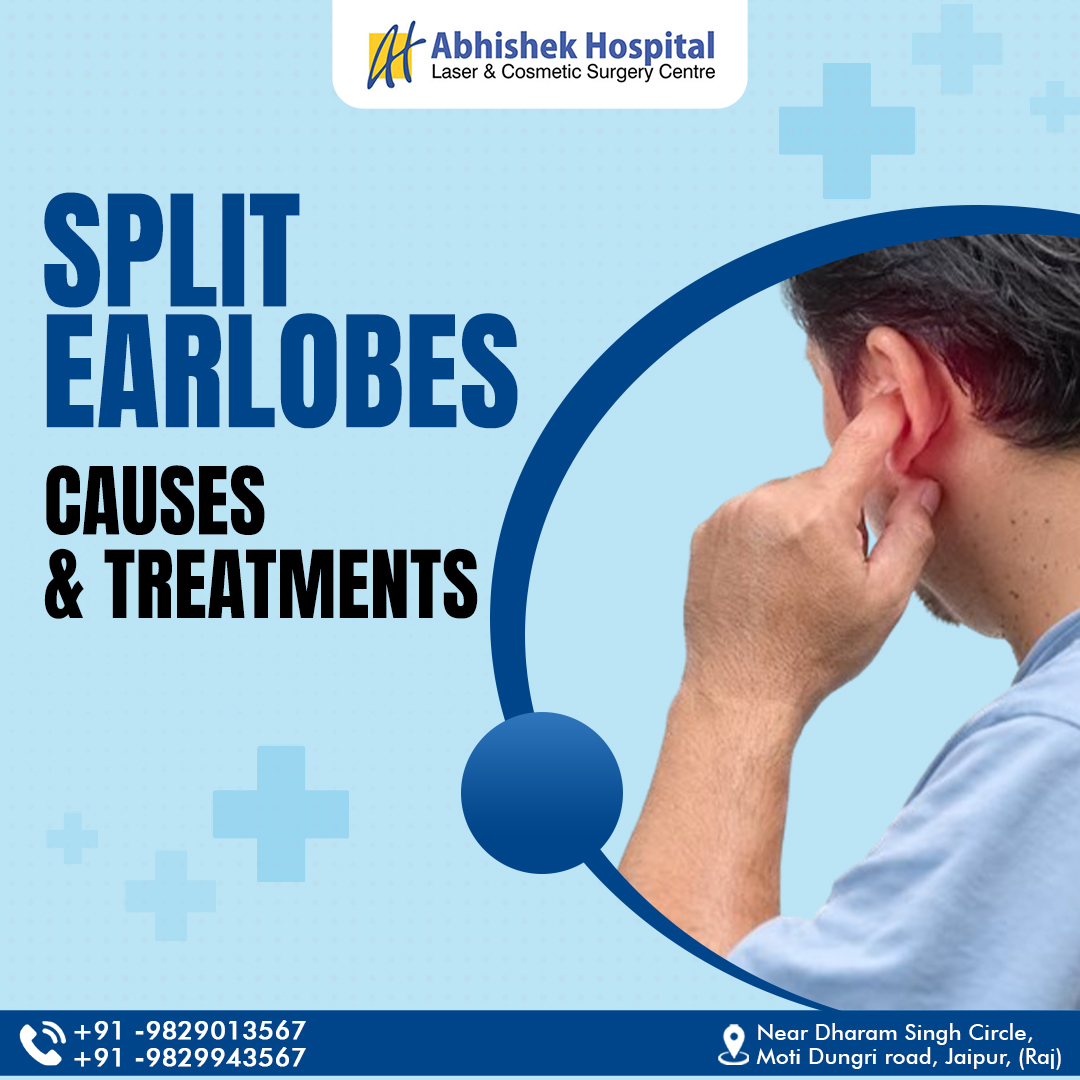 Split Earlobes Causes & Treatments