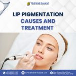 Lip Pigmentation