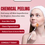 Advanced Chemical Peeling Treatment