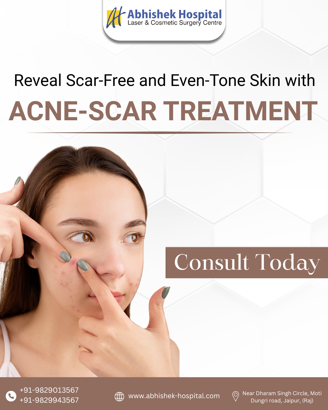 Tired of acne scars affecting your confidence?