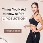 Things you need to know before Liposuction
