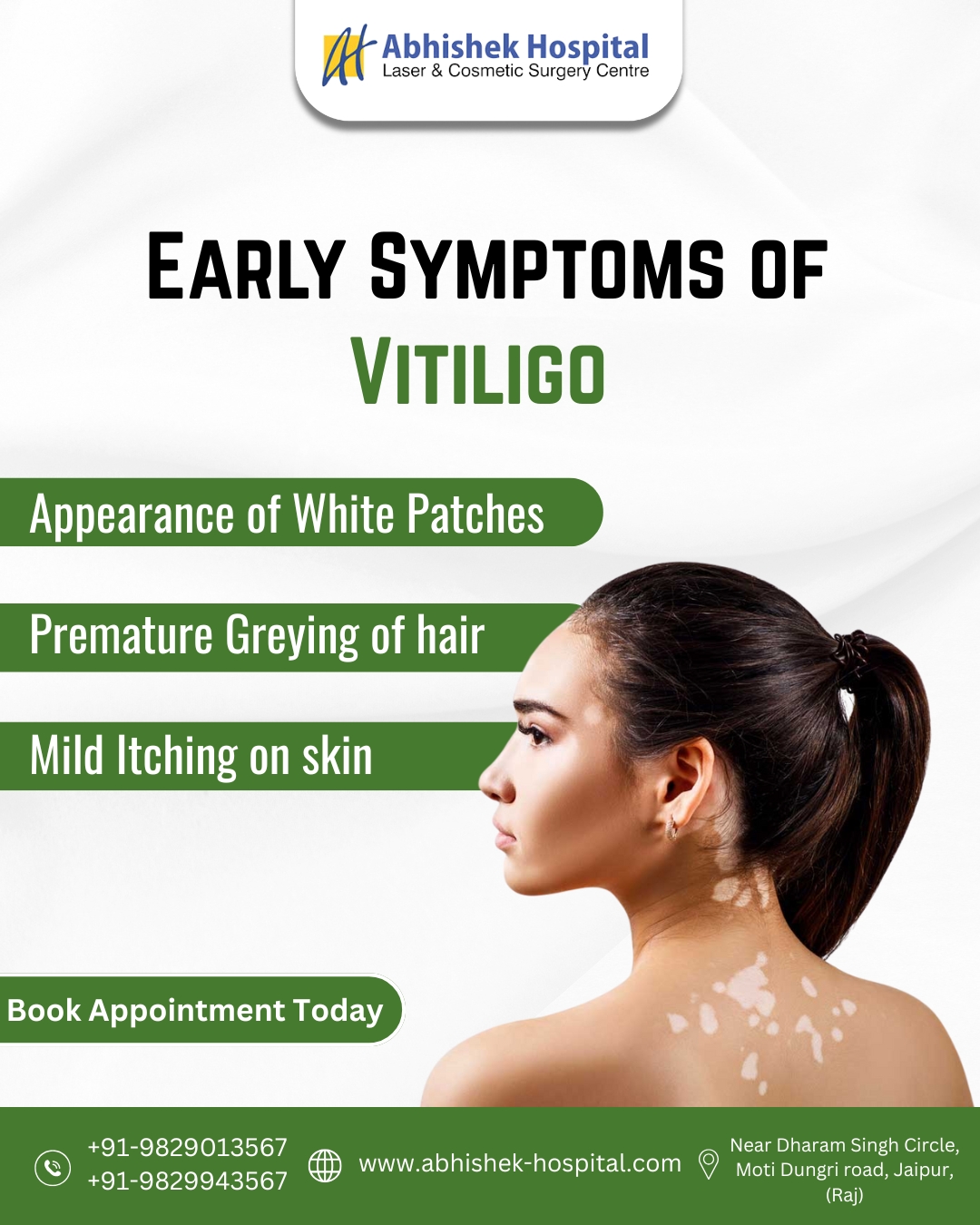 Early Symptoms of Vitiligo