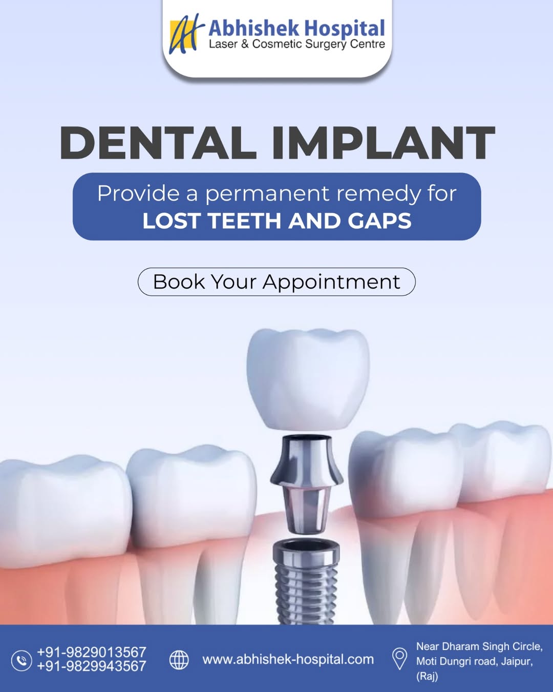 Long-Term Benefits of Dental Implants