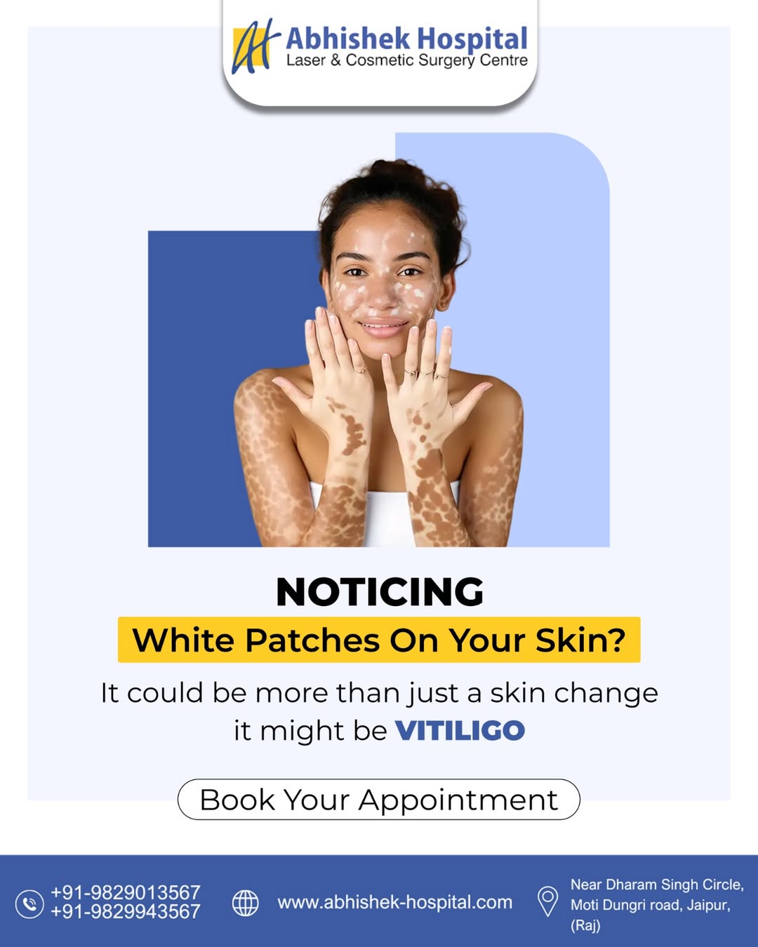 Early Signs of Vitiligo You Shouldn’t Ignore