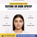 Chemical Peel Treatment