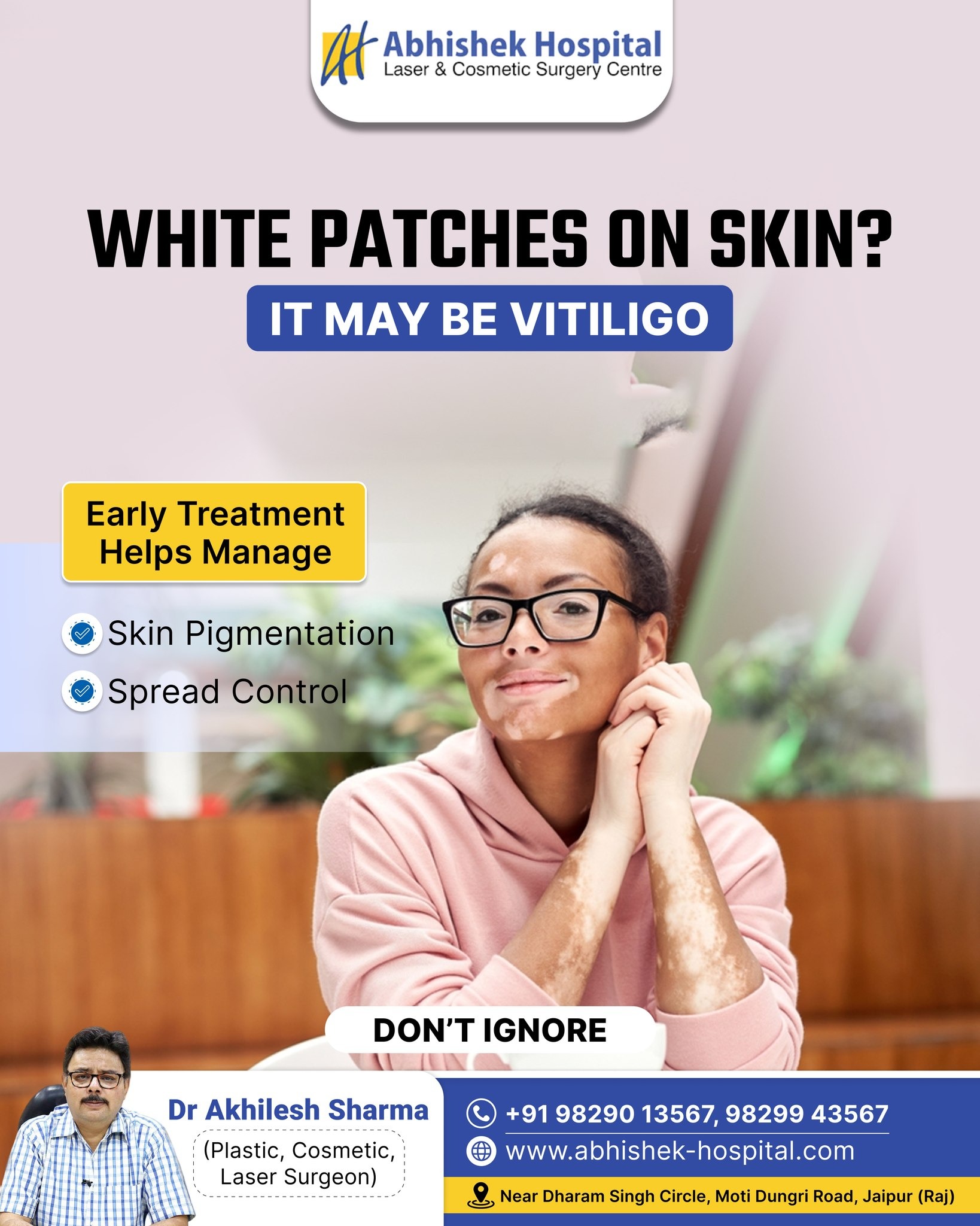 Vitiligo