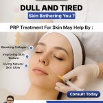 PRP Treatment
