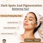 Chemical Peeling