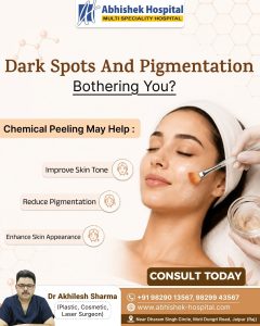 Benefits of Chemical Peeling