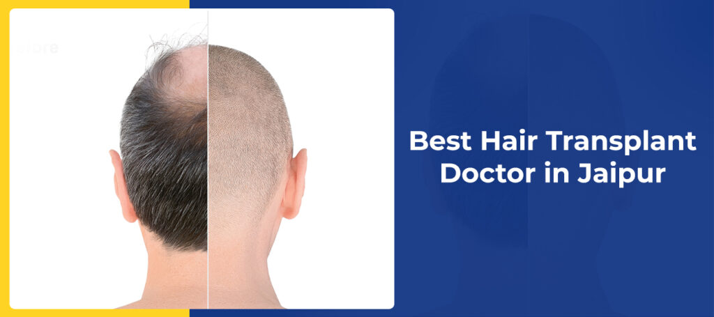 Hair Transplant Network where you can find pre-screened physicians as  chosen by real p...
                                            </div>

                                        </div>

                                    </div>
                                </div>
                                
                                <div class=