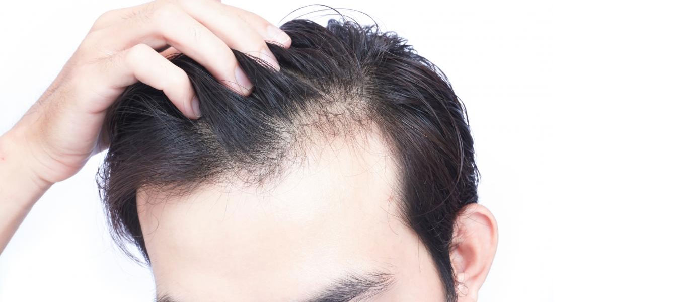 Hair Fall Treatment in Jaipur